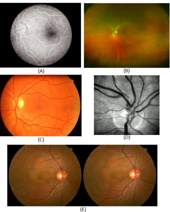 Figure 2.6: Some example images obtained from different fundus imaging techniques.