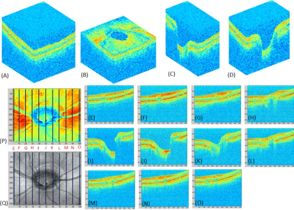 Figure 2.10: The SD-OCT example images captured by using the RTVue-100 system around the ONH area.