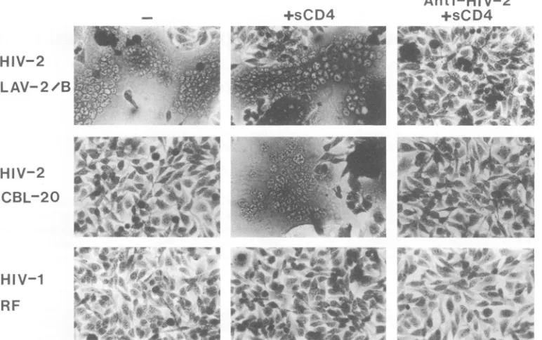 TABLE 1. Neutralization of HIV-2 fusion of RD cells