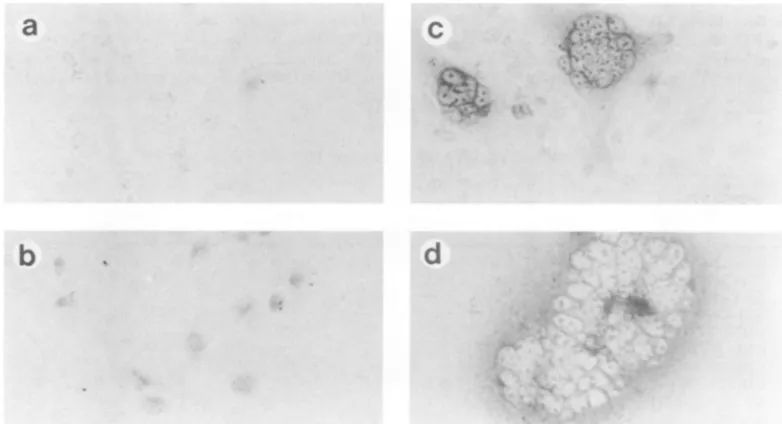 FIG. 2.maintainedtoafter CBL-20. Immunostaining by HIV-2 antiserum of RD cells exposed to HIV-2 strains CBL-20 and LAV-2/B