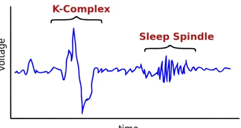 Figure 2: K-Complex and Sleep Spindle are signs of stage two sleep. Copyright
