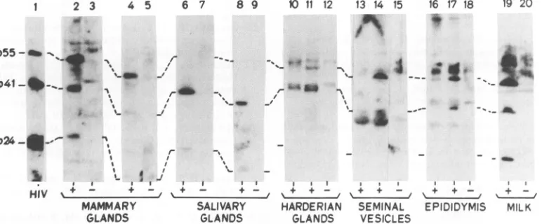 FIG. 3.wereprobedfromofrabbit proteins Western blot analysis ofgag proteins in tissues and milk of mice from line MMTV/HIV-R10