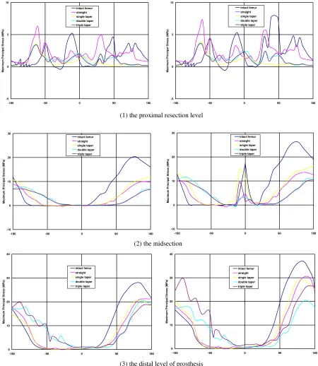Figure 7.  Variation of maximum principal stresses in cortical surface at different level for walking load case (left) and stair climbing (right)