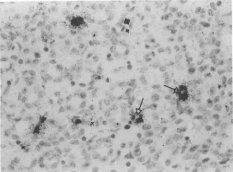 FIG. 6.ofthroughout mouse In situ hybridization on PID 5 of mesenteric lymph nodeinfected with MVMp.Labelednucleiarescattered the node