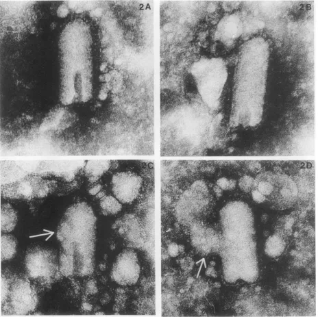 FIG. 2.protrusionsat atmospheric Electron microscopy of pressurized VSV negative stained with phosphotungstic acid