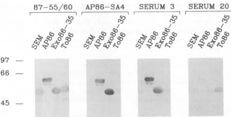 FIG. 8.gp86aminoproteins.aresite Linear antibody-binding site of glycoprotein gp86. The upper part shows the amino acid sequence of the amino-terminal region of from strains AD169 and Towne (bold letters)