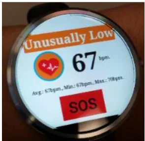 Fig. 14. SOS button on the smartwatch. 