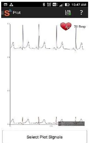 Fig. 9. Screenshot of ECG signals distinctly showing p,q,r,s,t segments for inspection