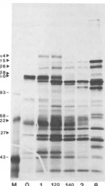 FIG.1.theprobefromtiveIE2,andanisomycin;harvestedprotein-codingvariouscontrol.probesIE Kinetics and metabolic requirements for accumulation of mRNAs