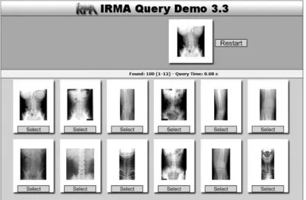 Fig. 2.3: Some of the retrieved images with IRMA tool.