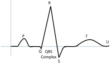 Figure 1: A stylized ECG signal of one heart beat. 