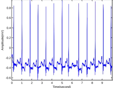 Figure 8: An Original ECG signal (Source: MIT/BIH database) 