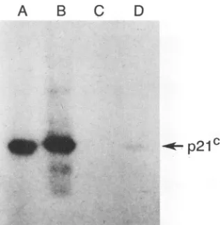 FIG. 3.Corenalantibodyanti-HBcSDS Binding of monoclonal antibody (no. 2212) with p2lc