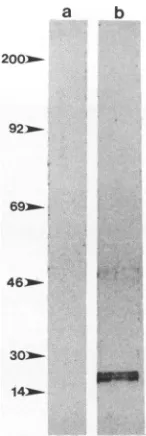 FIG. 1.boundorpreincubated postimmune VOPBA with 2 mg of protein from L cells (lanes a to d), SCP cells (lanes e to h), and GSM cells (lanes i to r)