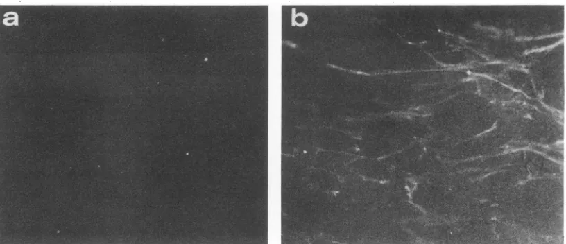 FIG. 4.5 (b), Immunofluorescence assay of SCP cells using preimmune serum from rabbit 2-23 (50-kDa protein) (a) or postimmune serum bleed each at a dilution of 1:20.