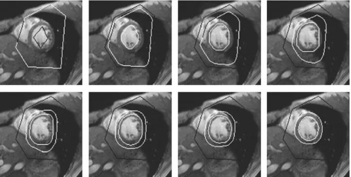 Figure 2.6 – Deformable models and anatomical constraints for the segmentation of the LV.