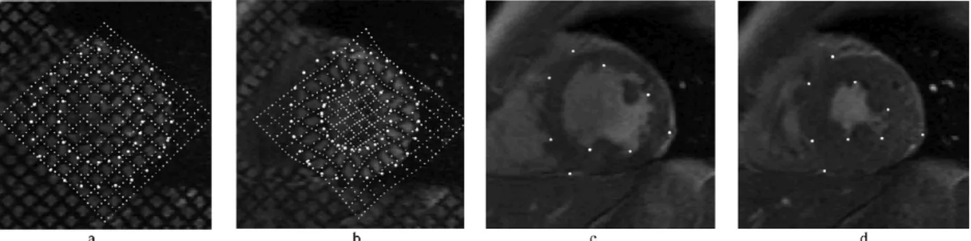Figure 3.1 – Example of contour tracking from [Remme et al., 2005]. Short-axis tagged MR images are shown at ED in (a) and ES in (b) with the tracked image stripe points