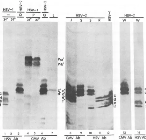 FIG.5.dash(HSVIgGseparatedto(390;(HSV-1)plasmidstify a Photograph of polypeptides from cells transfected with and either mock infected or superinfected with HSV-1(F) or HSV-2(G) (HSV-2) at 340C (340; lanes 1 and 4), 39°C lanes 2 and 5), or 370C (lanes 3 an