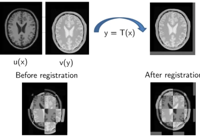 Figure 2.8: Optimization process of a geometrical transformation T so that corresponding features in the images overlap.