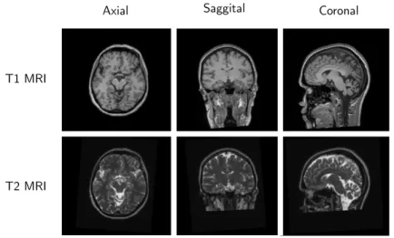 Figure 4.5: Slices through a pair of registered T1 and T2 MRI volumes of the IXI data set.
