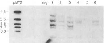 FIG. 3.atPstI6755andbandfrequently5fromflankingDNAretained(patientsitconservedusedlanesrestrictioninternalHTLVHTLV-ILanes1392 has is insertion Southern blot analysis of genomic DNA from PBMCs patients with ATL