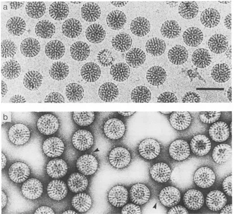 FIG.1.mayainstaining stained the Rotavirus (isolated in the presence of trypsin) imaged by cryoelectron microscopy in amorphous ice and by low-dose negative with uranyl formate
