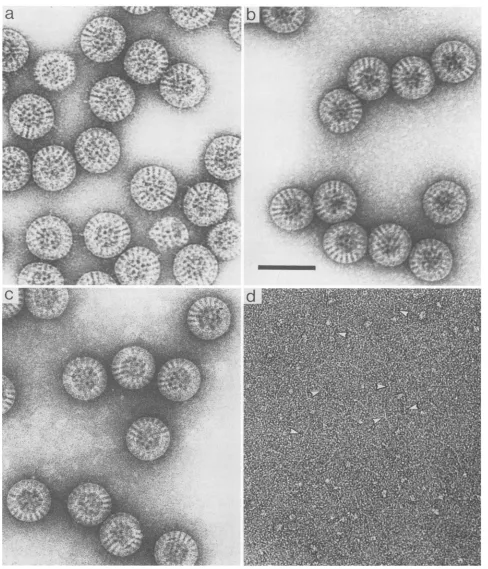 FIG. 2.capsidbackgroundandlinearbackgroundammoniumuncleaved Effect of ammonium hydroxide treatment on rotavirus as revealed by negative staining and low-dose microscopy