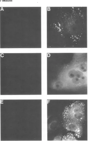 FIG. 7.antiserum;asMV.normalUV those Indirect immunofluorescence analysis of the MV P and V proteins in uninfected Vero cells and Vero cells 16 h after infection with Cells were fixed in 2.5% paraformaldehyde in PBS, permeabilized with 0.5% Triton X-100 in