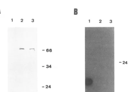 FIG. 6.catedcorrectonfactorfilteraminotranscript.17.5% Absence of RNA-binding capacity in N-terminal-trun- rex proteins