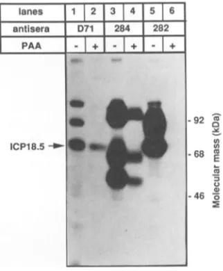 FIG. 4.incubatedfiltercells.harvestedwereandabove Time course of ICP18.5 accumulation in PRV-infected PK15 cells were infected with PRV at an MOI of 10 and at various times by lysis in RIPA buffer