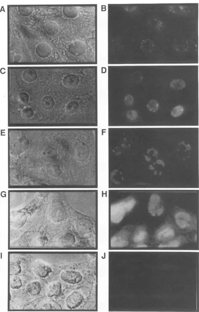 FIG. 6.eitherpermeabilized(J).phase Intracellular localization of ICP18.5 in PRV-infected cells