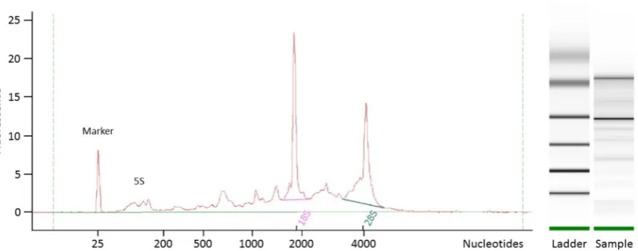 Figure 2  Electropherogram and gel image to calculate RNA quality. A typical electropherogram of total RNA of human EC