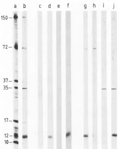 FIG. 5.fororwith(laneanalyzed.culturetion24BB7.lanex 105 L Sequestration of ASF virus-binding proteins by MAb OG-released virus proteins labeled with [35S]methionine (4.7 cpm; 1.6 jig of protein; lane b) were incubated with 400 pAl of medium from MAb 24BB7