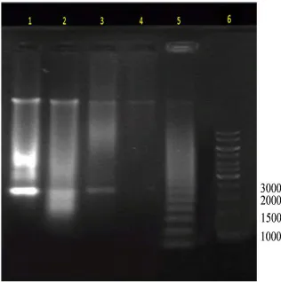 Fig 4. DNA fragmentation of MDA-MB 231 breast cancer cells analysed in 1% agarose gel after 24hours incubation with different concentration of Artonin E