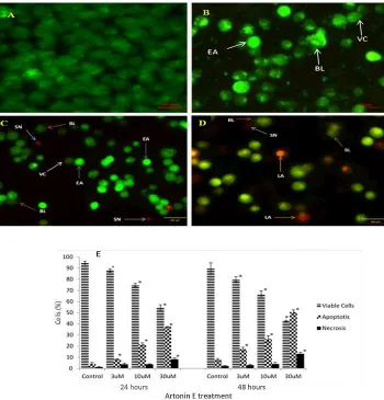 Fig 2. Acridine orange and propidium iodide double staining of MDA-MB 231 breast cancer cells after24 hour exposure