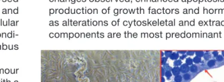 Figure 2.2.1.1: The pictures show an example of engineered vascular endothelial tubes