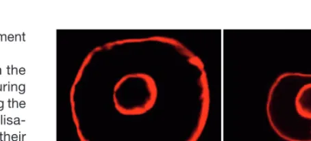 Figure 2.2.1.4: Fish otoliths under f uorescent light: The f sh bearing these inner ear stones were fed with a calcium-tracer once at the beginning of an experiment (inner circular labelling) and once again after some days (outer labelling)