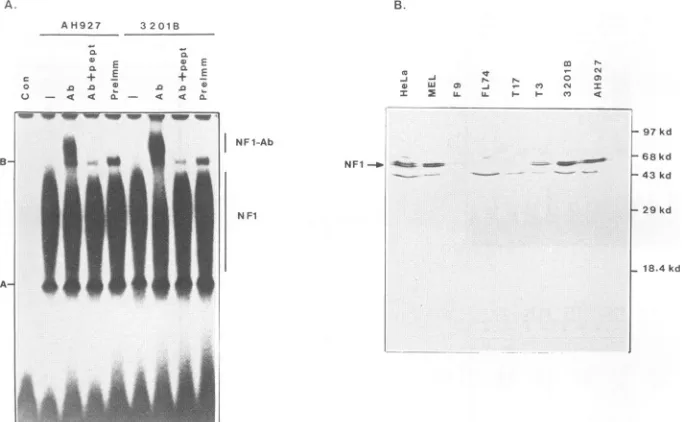FIG. 6.inextract(PreImm).andanti-rabbitantiserumare,ul) a Western blot analysis of nuclear NFl