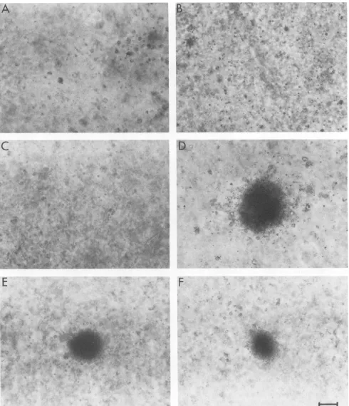 FIG. 7.(F)erythroidresultingusing Erythroid colonies induced by mutant and wild-type AEV