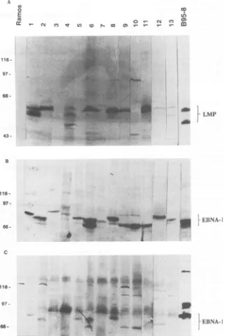 FIG. 2.Ramosas10serum, the were Immunoblots showing expression of EBV proteins in NPC biopsies
