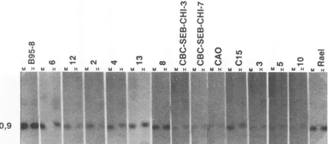 FIG. 6.916-bpDNAs Methylation of the oriP region in NPC biopsies. Same blot shown in Fig