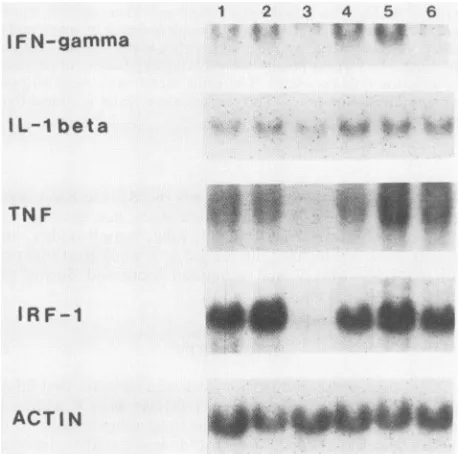 TABLE 1. Summary of cytokine mRNA expression in variousorgans from a C57BL/6 mouse infected withLP-BM5 MuLV for 16 weeks