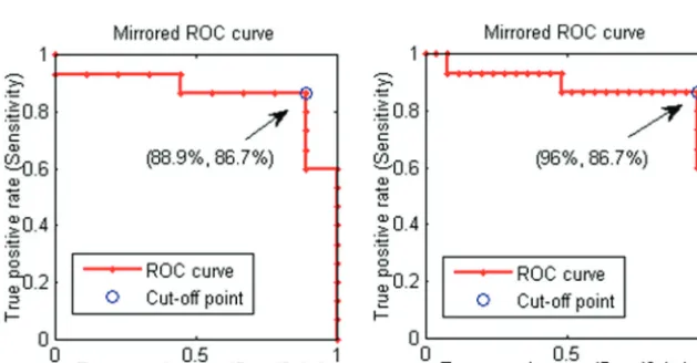 FIG 4. Fraction of the midrange MD voxels (�parenchyma MD values and a lower number of the voxels with MDvalues closer to CSF