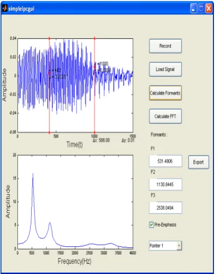 FIG 2.OUTPUT OF SPEECH SYNTHESIS USING MATLAB