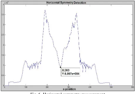 Fig. 6. Horizontal symmetry measurement 