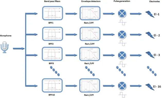 Figure 1.5: Cochlear implant Signal processing 