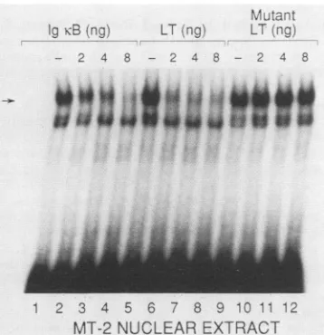 FIG.6.formNF-KB.oligonucleotidesrespectively)otidea9). complex Demonstration that mutated LT KB site does not bind Nuclear extract from MT-2 HTLV-I-infected T cells forms with a radiolabeled oligonucleotide Ig KB (lanes 1, 5, and Complex formationis inhibi