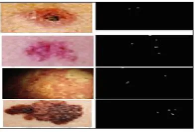 Fig 4: (A) Original Skin Image, (B) Edge for all regions, (C) Edge for Center Skin Image