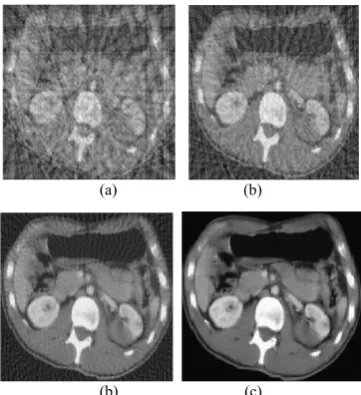 Fig. 3. Reconstructed image of the standard medical image, by FBP (with Sheep logan filter) using  (a)16, (b) 32, (c) 64 and (d) 180 projections