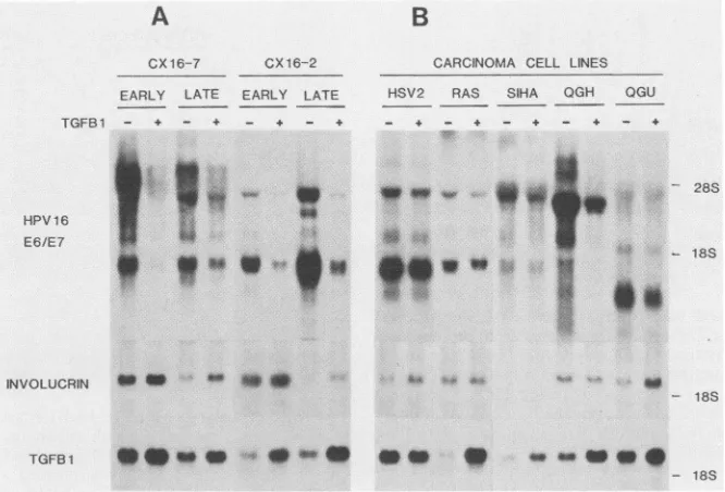 FIG. 6.cellTGFPpassage.linescell Effect of cell passage or malignant transformation on TGFP 1-mediated changes in gene expression
